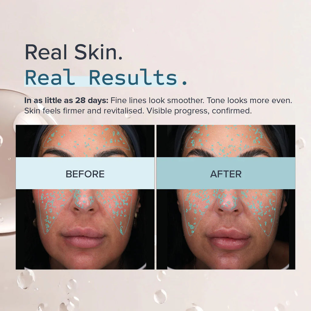 Alumier MD IntelliRET™ 0.3+ Retinolio serumas 30ml